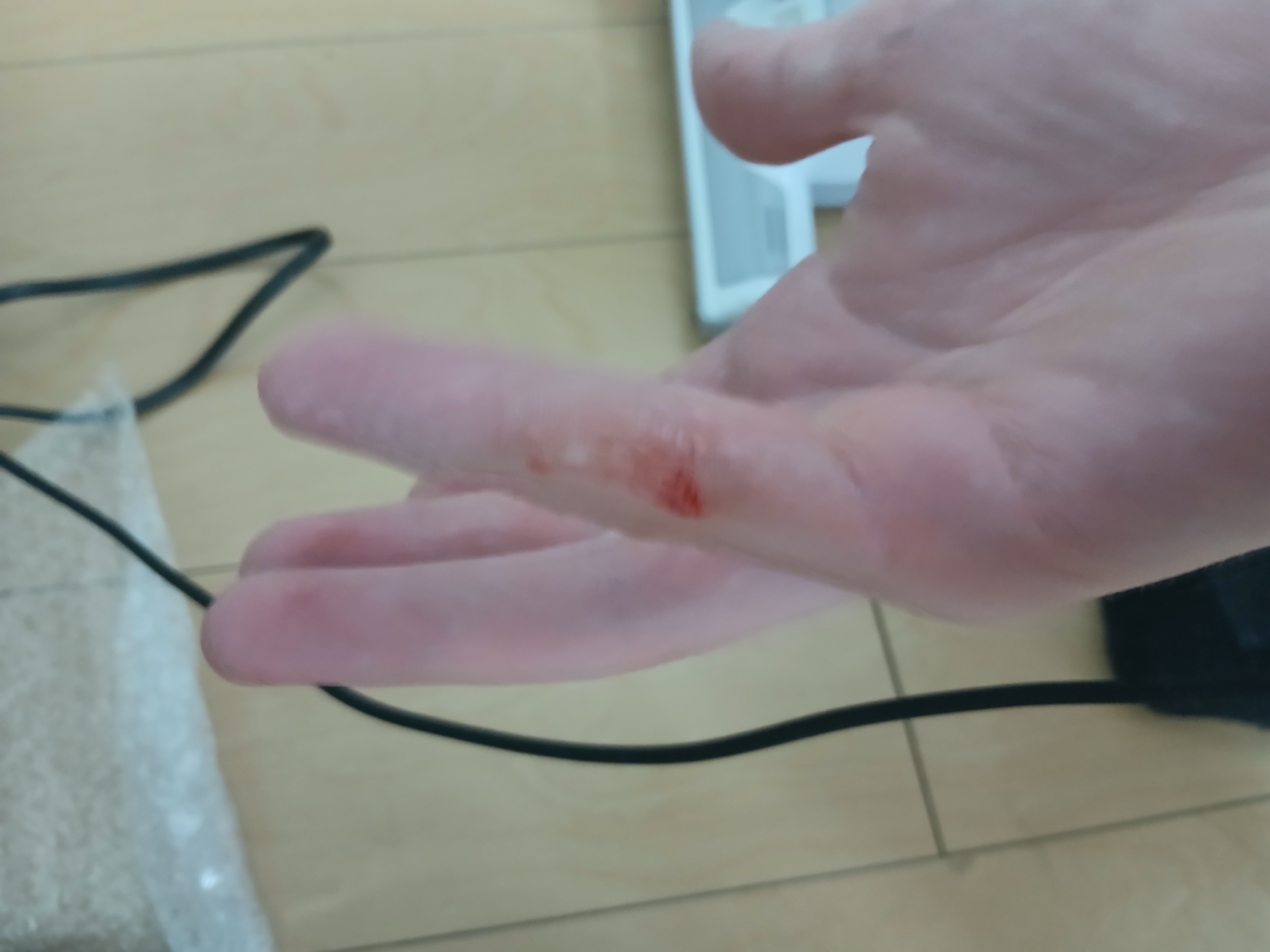 ouch